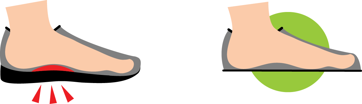 No Arch Support