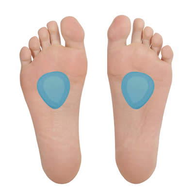 metatarsal-pads-400