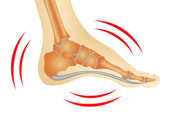 Swelling Foot swelling-foot-600
