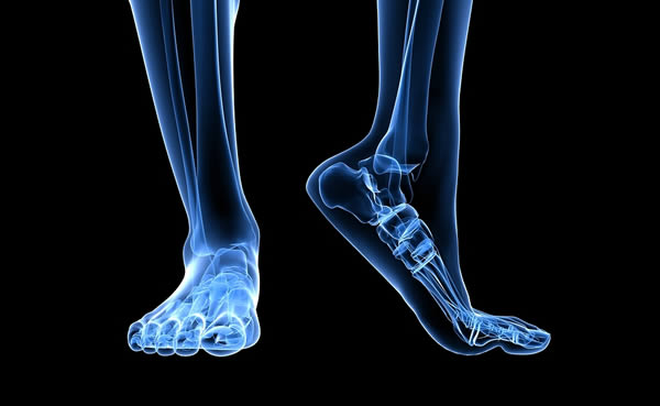 Minimalist Shoes Increase Let and Foot Muscles, Prevent Injury x-ray-foot-legs
