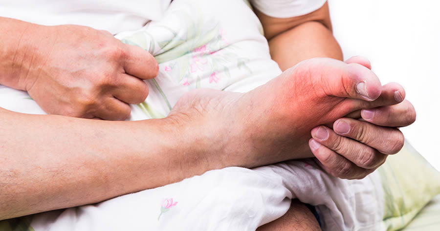 Best Shoes for Gout: What to Look For