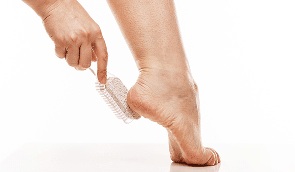 Scrubbing a foot callus with a pumice stone