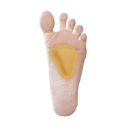 Metatarsal Pads under a foot