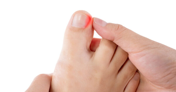 Best Shoes for Ingrown Toenails: Tips for Prevention and Treatment