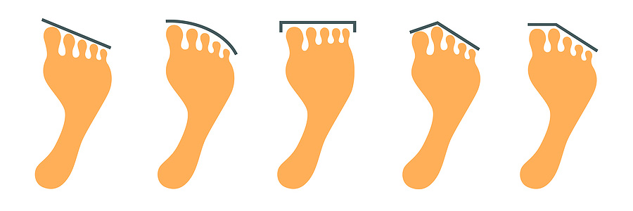 Different toe shapes