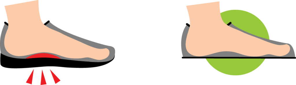 The lack of arch support in barefoot shoes is better for shin splints